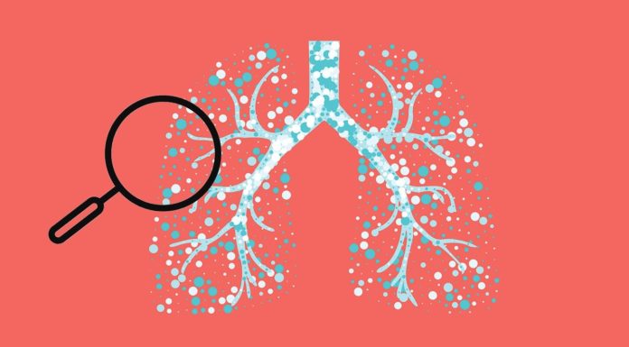 What Is Asthma? Symptoms, Causes, Diagnosis, Treatment, and Prevention