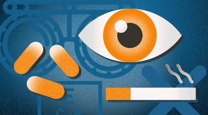 What Is Macular Degeneration? Symptoms, Causes, Diagnosis, Treatment, and Prevention