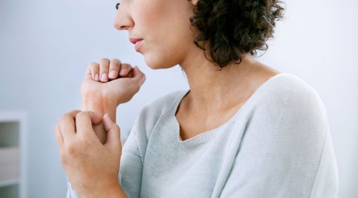 What Is Psoriasis? Symptoms, Causes, Diagnosis, Treatment, and Prevention