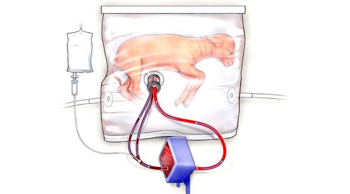 Fetal Lambs in ‘Biobags’ Show Promise for Artificial Human Wombs