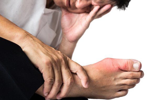 7 Gout Remedies to Prevent and Relieve Pain Quickly