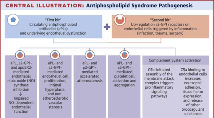 What Is Antiphospholipid Syndrome?