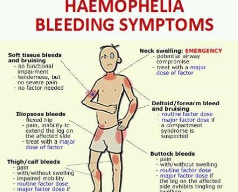 What Is Hemophilia? Symptoms, Causes, Diagnosis, and Treatment
