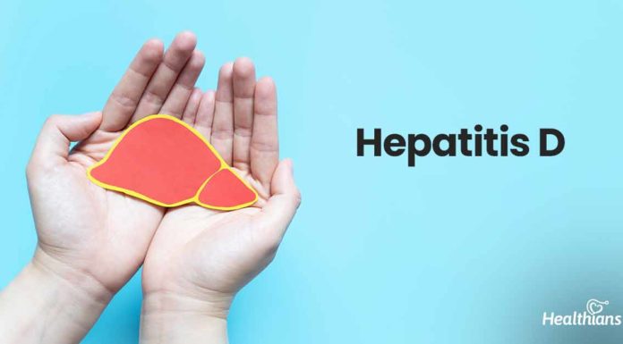 What Is Hepatitis D? Symptoms, Causes, Diagnosis, Treatment, and Prevention
