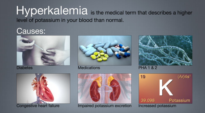 What Is Hyperkalemia? Symptoms, Causes, Diagnosis, Treatment, and Prevention