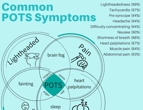 What Is Postural Orthostatic Tachycardia Syndrome (POTS)? Symptoms, Causes, Diagnosis, Treatment, and Prevention
