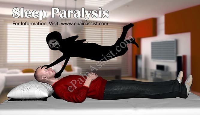 What Is Sleep Paralysis? Symptoms, Causes, Diagnosis, Treatment, and Prevention