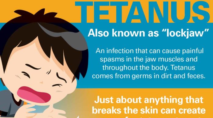 What Is Tetanus? Symptoms, Causes, Diagnosis, Treatment, and Prevention