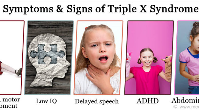 What Is Triple X Syndrome? Symptoms, Causes, Diagnosis, Treatment, and Prevention