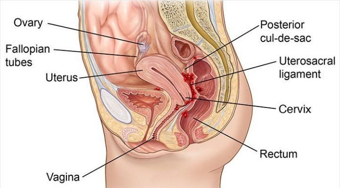 What Is Vulvodynia? Symptoms, Causes, Diagnosis, Treatment, and Prevention
